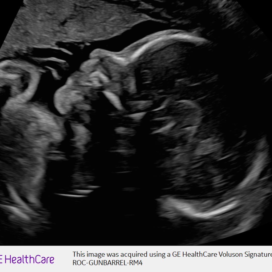 Photo shared by Celien for their Babylist baby registry.