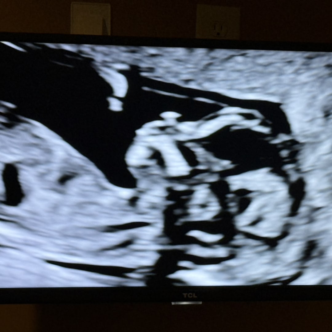 Photo shared by Vanessa for their Babylist baby registry.