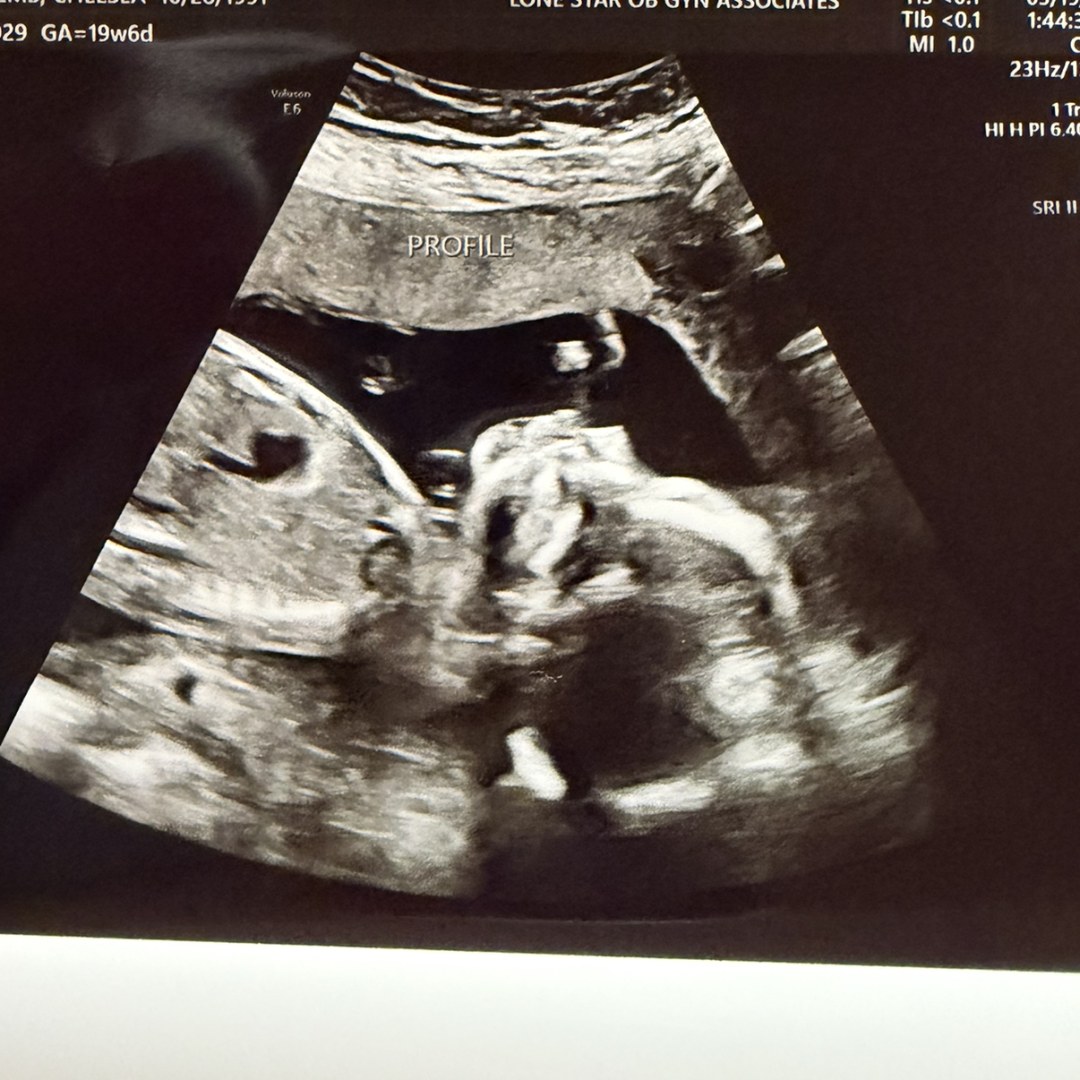 Photo shared by Chelsea for their Babylist baby registry.