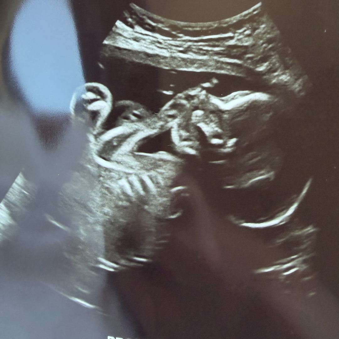 Photo shared by Ashly for their Babylist baby registry.