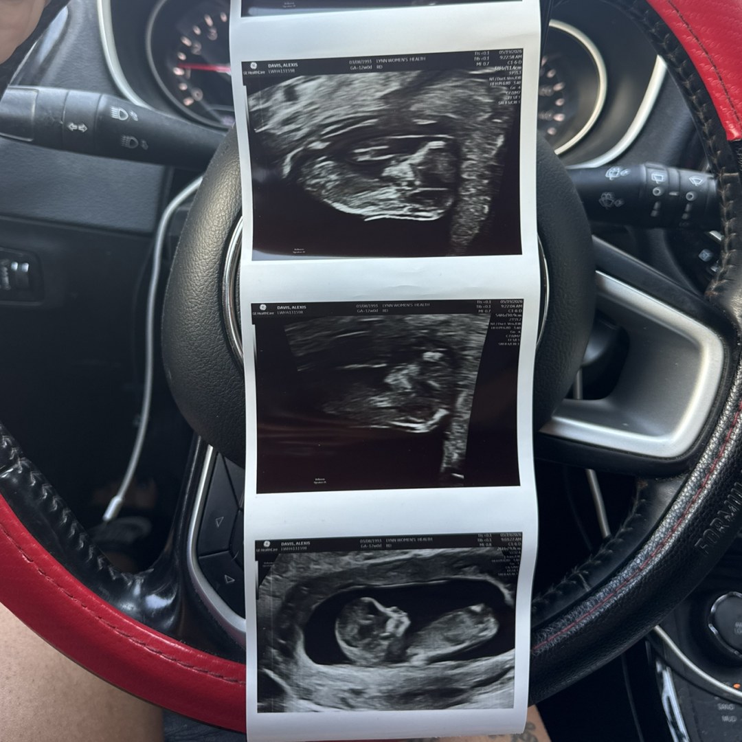 Photo shared by Alexis for their Babylist baby registry.