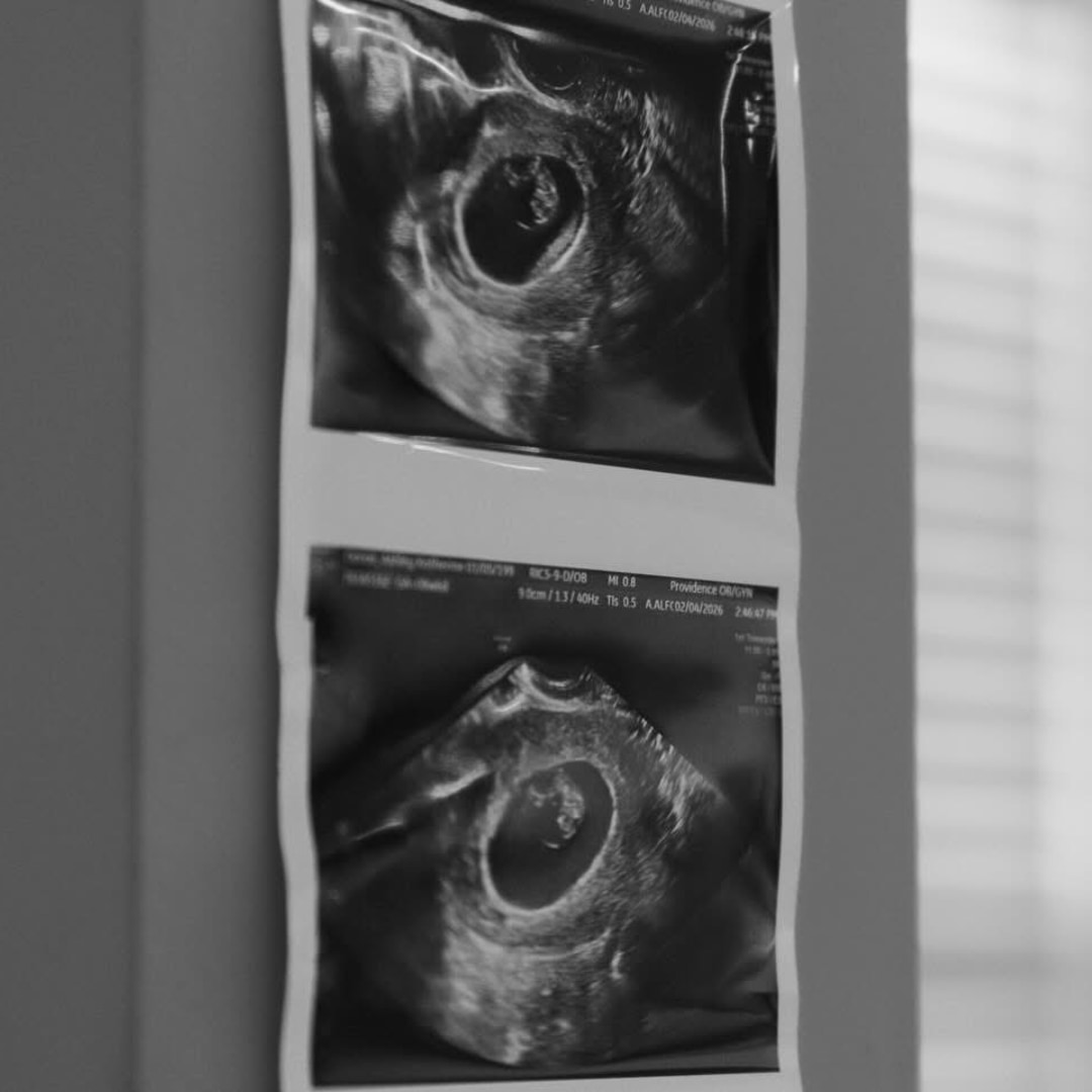 Photo shared by Ashley for their Babylist baby registry.