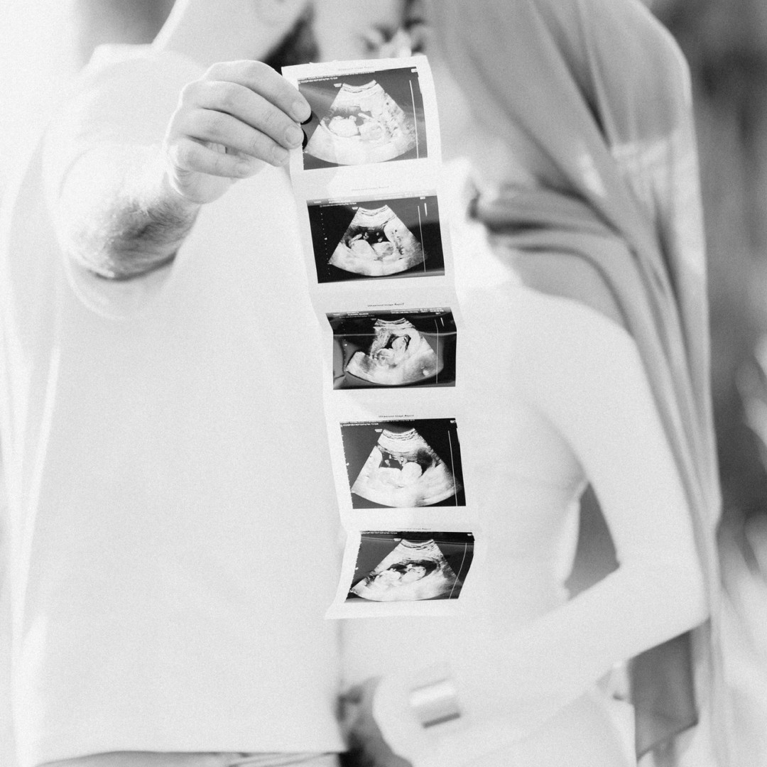 Photo shared by Sejoud for their Babylist baby registry.