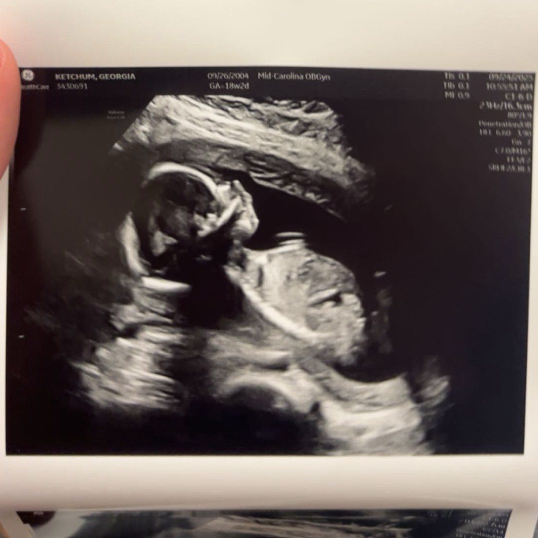 Photo shared by Ashe for their Babylist baby registry.