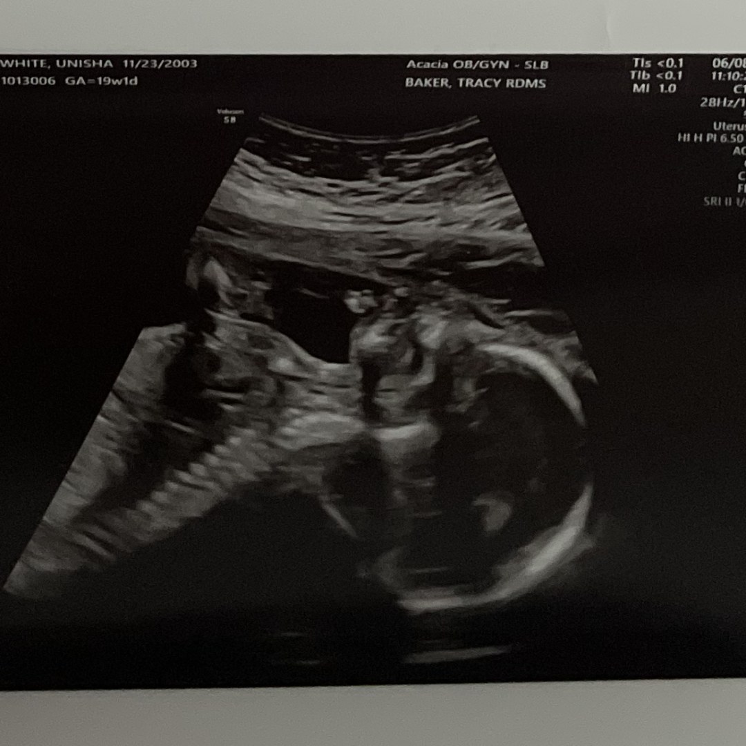 Photo shared by Nisha for their Babylist baby registry.