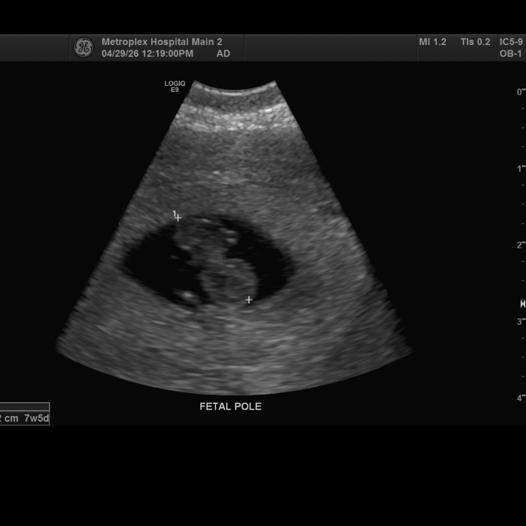 Photo shared by Makenzie for their Babylist baby registry.