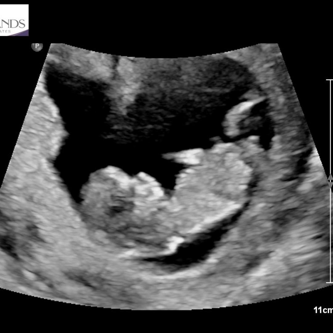 Photo shared by Alex for their Babylist baby registry.