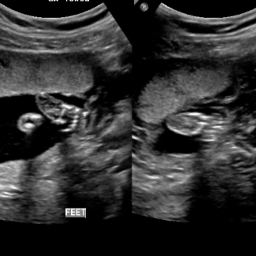 Photo shared by Dakota for their Babylist baby registry.