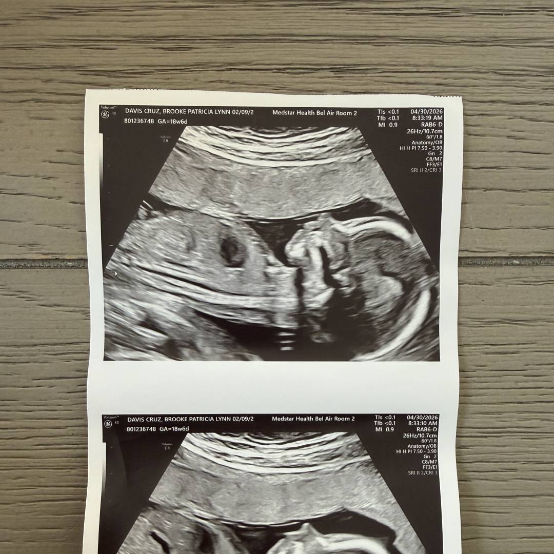 Photo shared by Brooke for their Babylist baby registry.