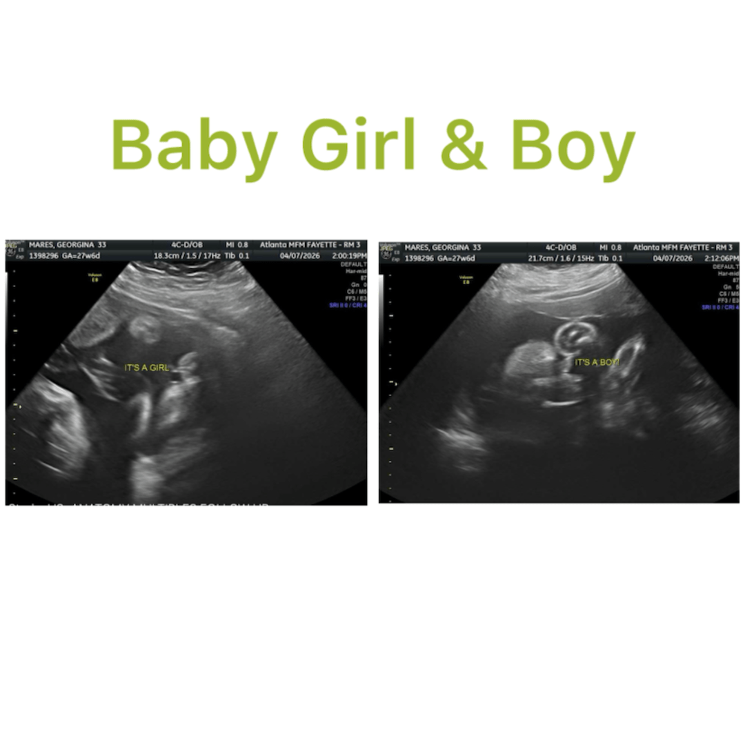 Photo shared by Georgina for their Babylist baby registry.