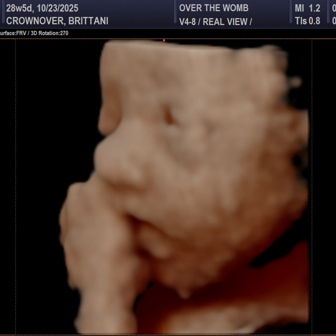 Photo shared by Brittani for their Babylist baby registry.