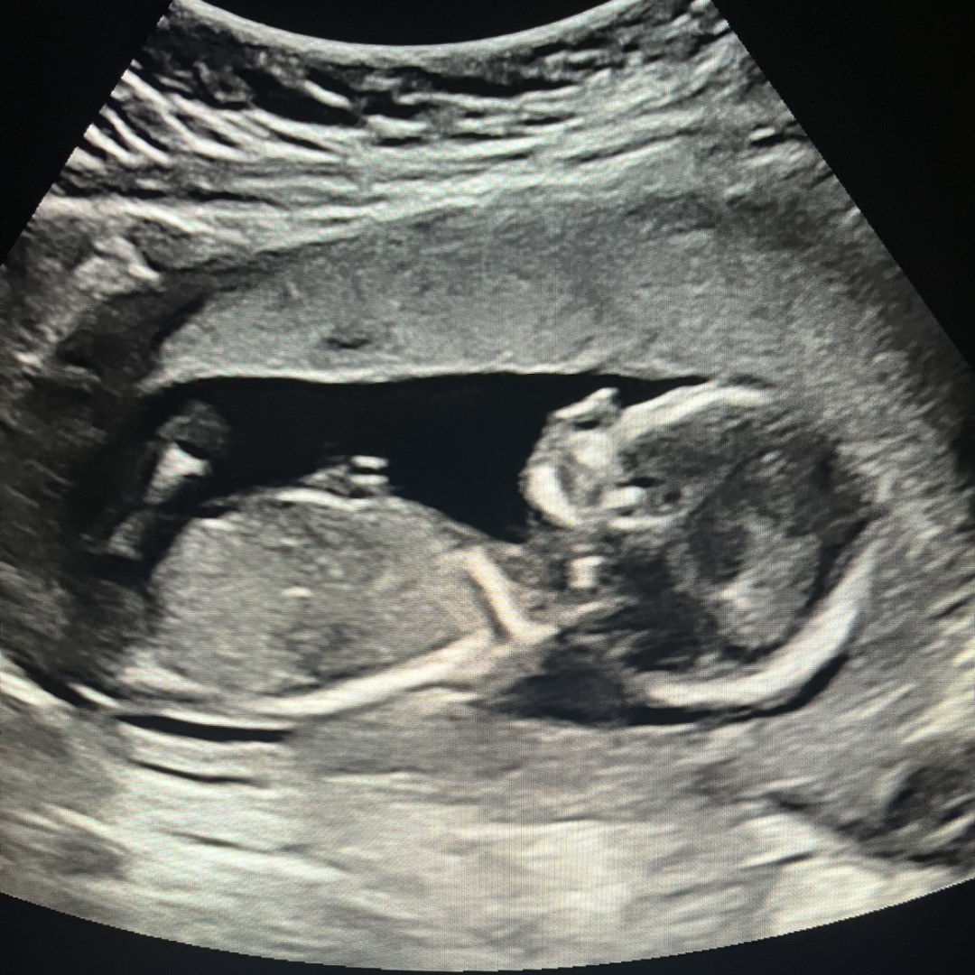 Photo shared by Heather for their Babylist baby registry.