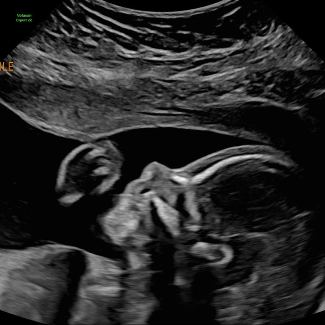 Photo shared by Annabelle for their Babylist baby registry.