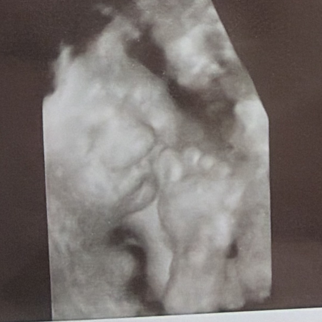 Photo shared by Skyler for their Babylist baby registry.