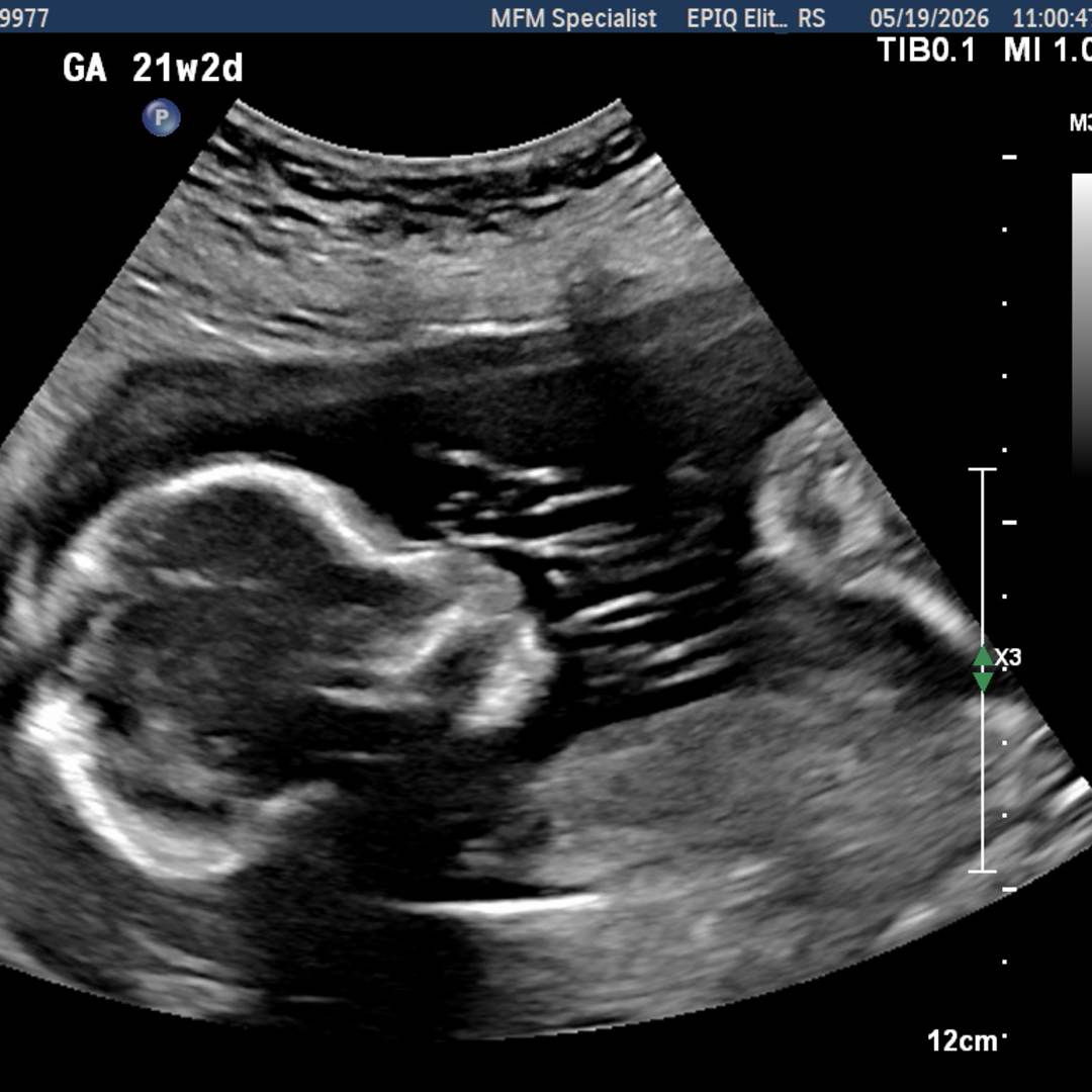Photo shared by Darcie for their Babylist baby registry.