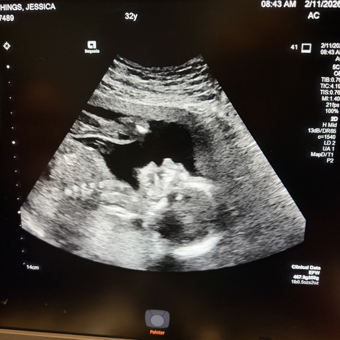 Photo shared by Jessica for their Babylist baby registry.