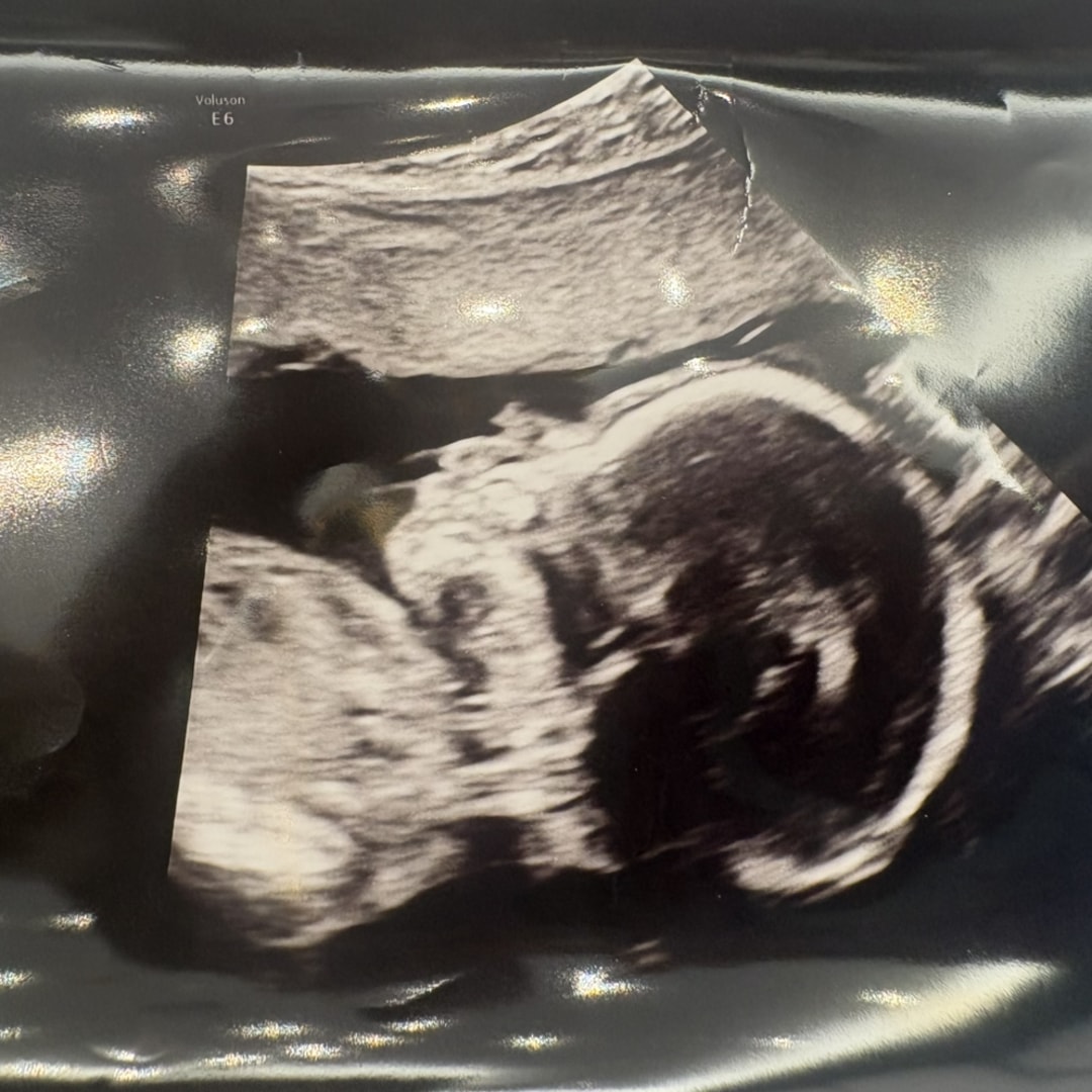 Photo shared by Amya for their Babylist baby registry.