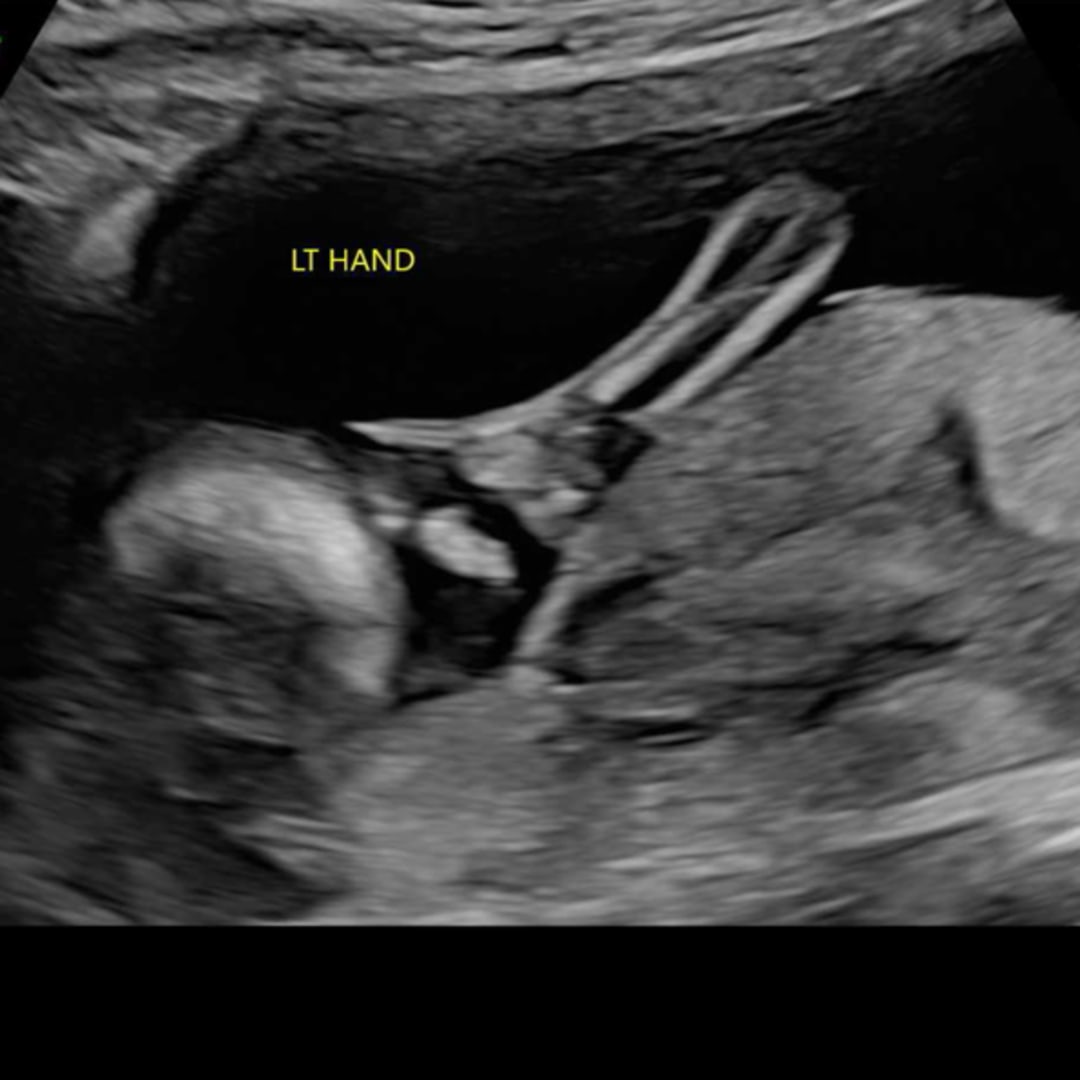 Photo shared by Haleigh for their Babylist baby registry.