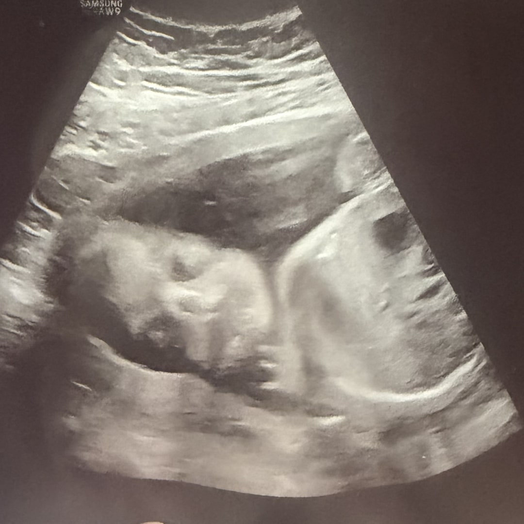 Photo shared by Christina for their Babylist baby registry.