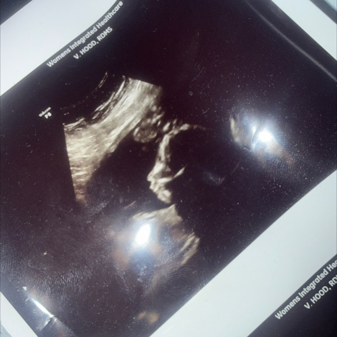 Photo shared by Sarah for their Babylist baby registry.