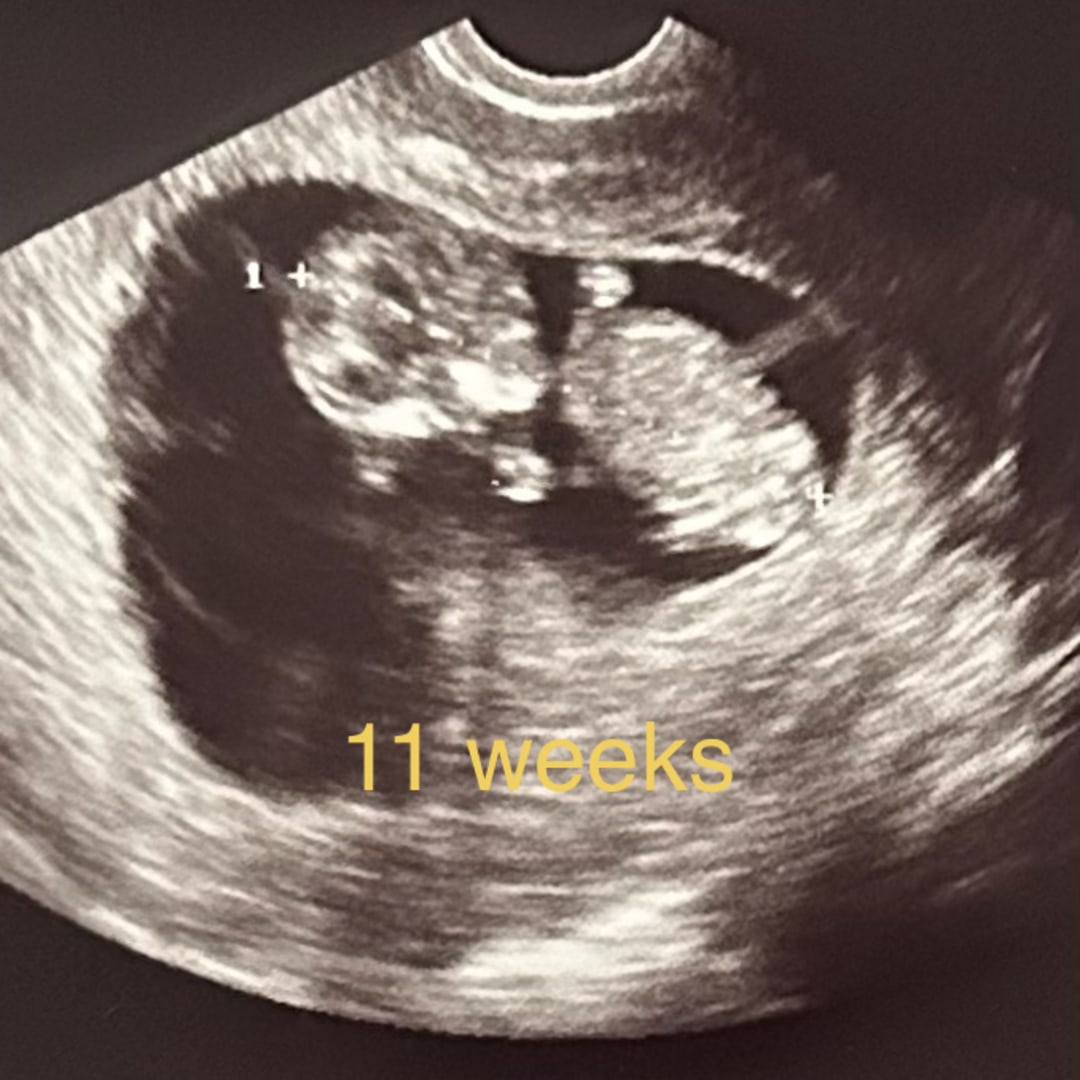 Photo shared by Tristian for their Babylist baby registry.