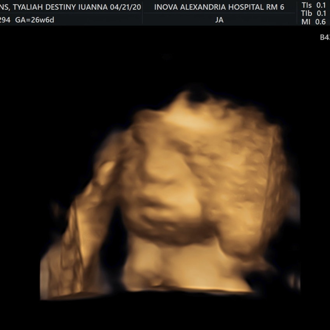 Photo shared by Tyaliah for their Babylist baby registry.