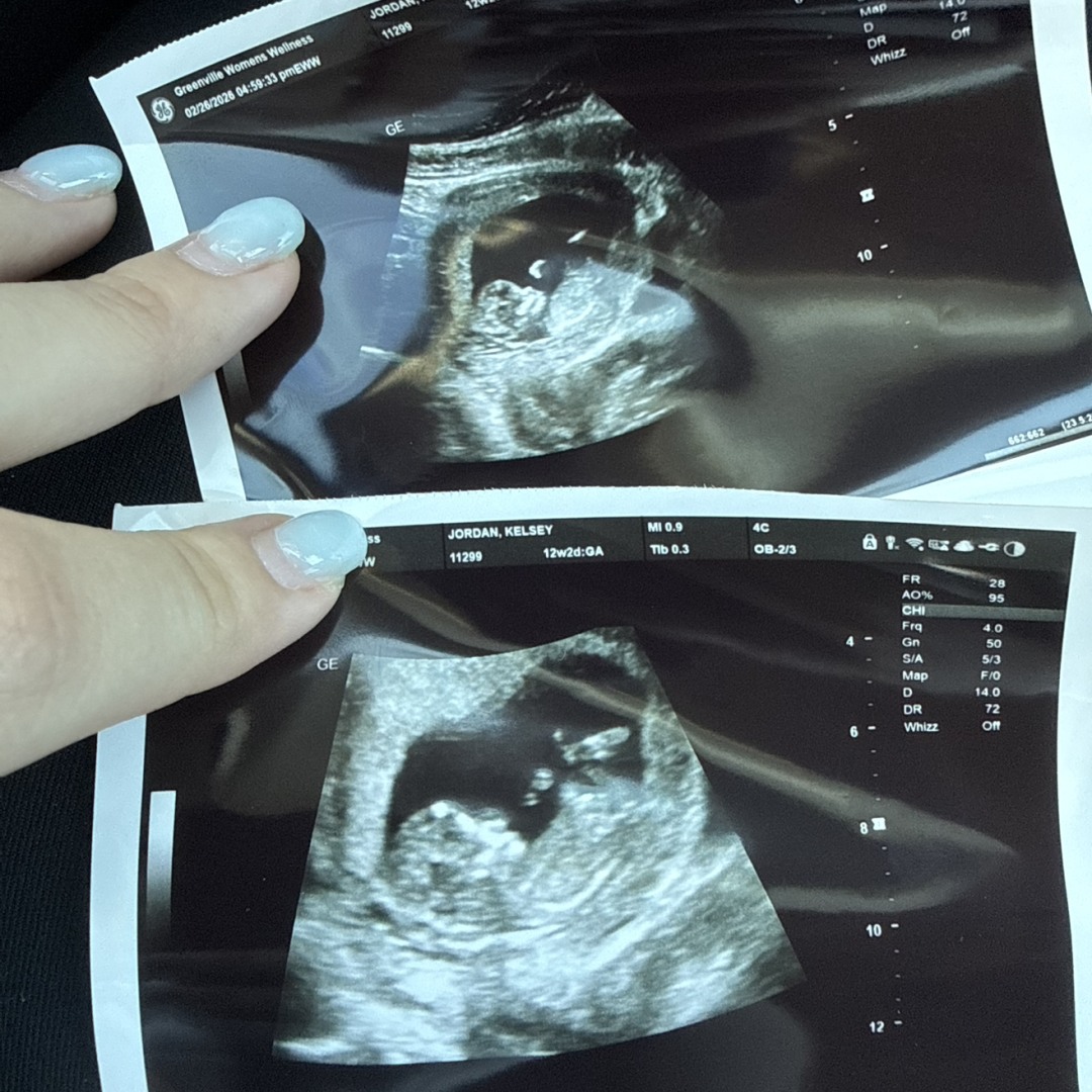 Photo shared by Kelsey for their Babylist baby registry.