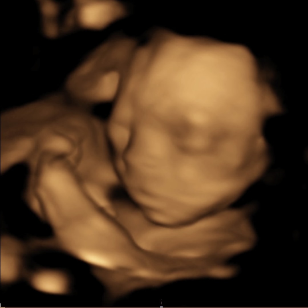 Photo shared by Jasmine for their Babylist baby registry.