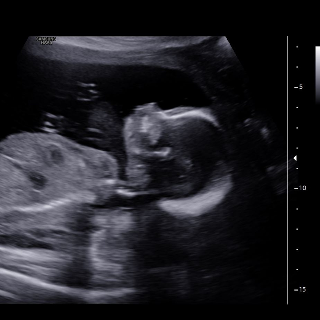 Photo shared by Kaitlyn for their Babylist baby registry.