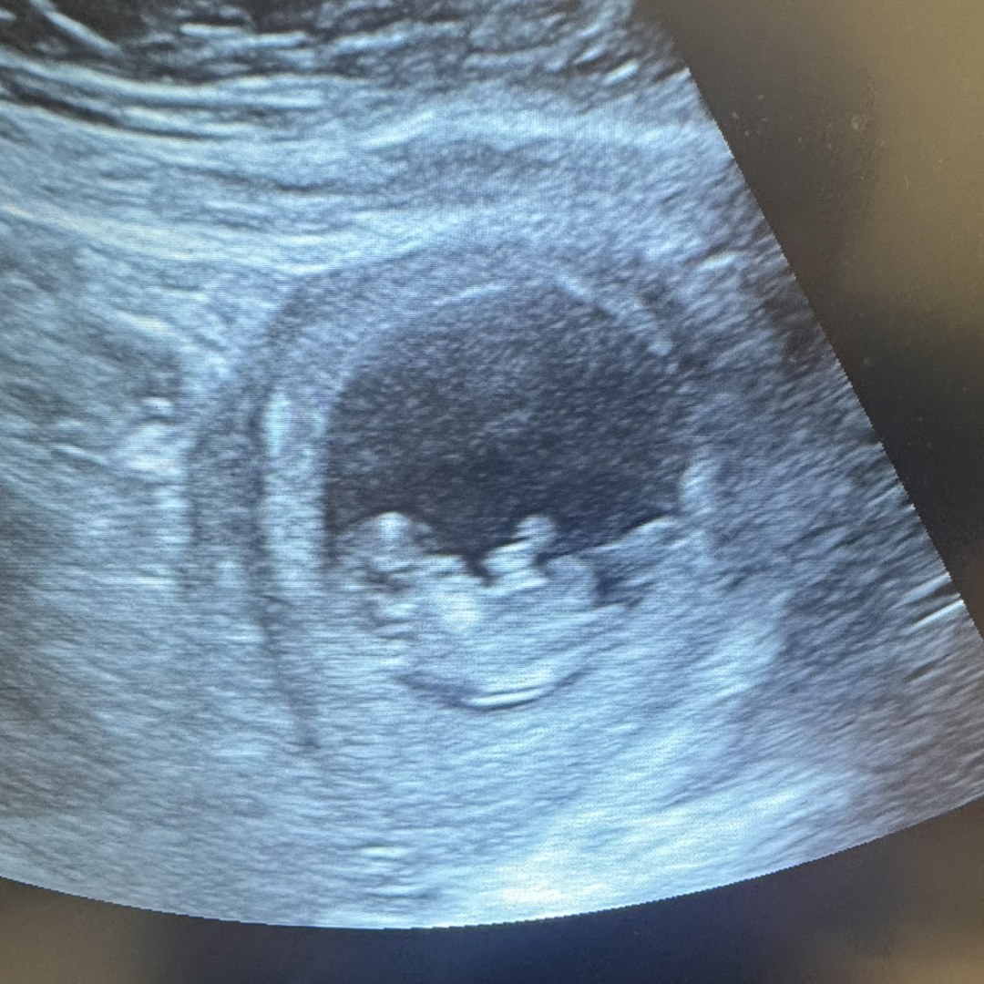 Photo shared by Tori for their Babylist baby registry.