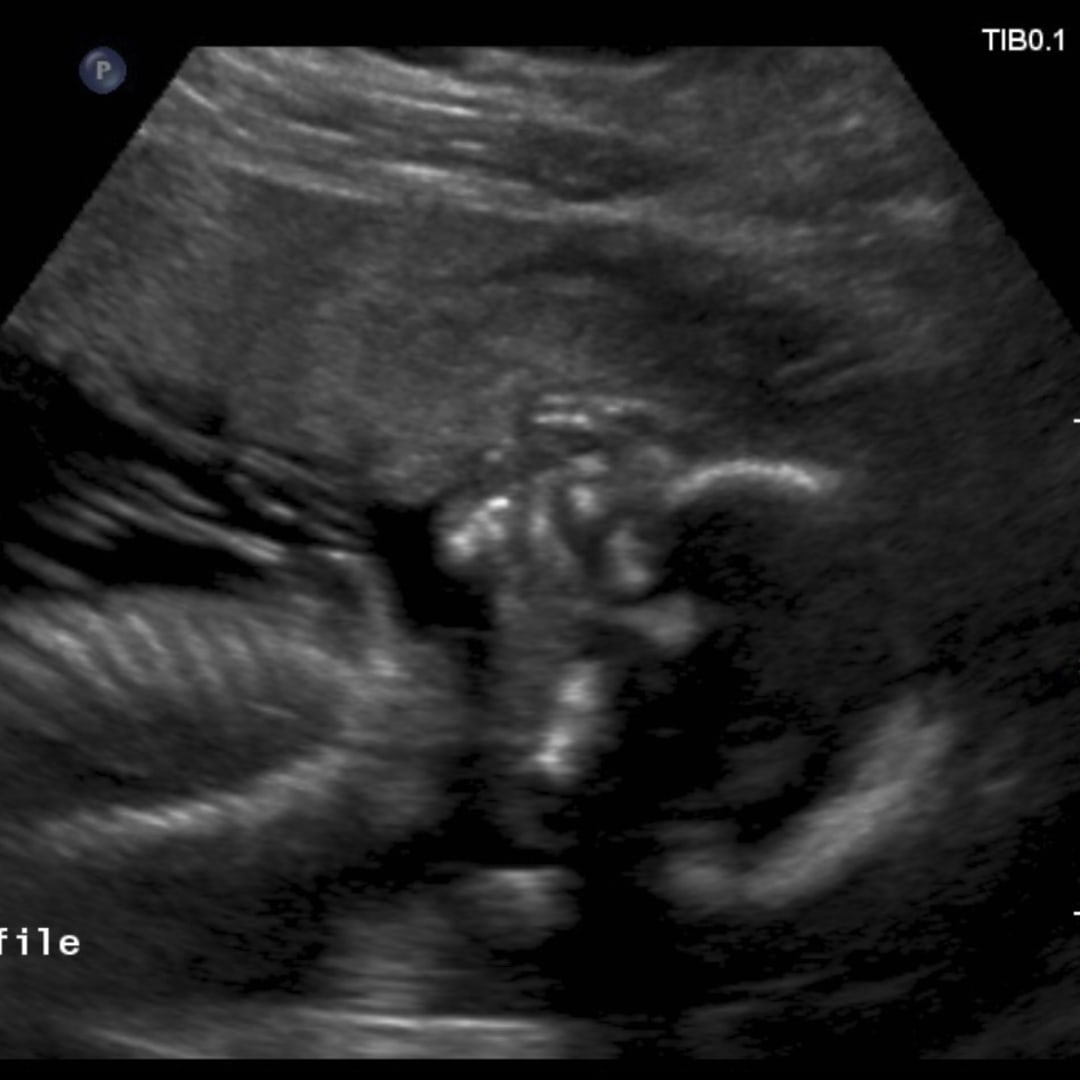 Photo shared by Ashanti for their Babylist baby registry.