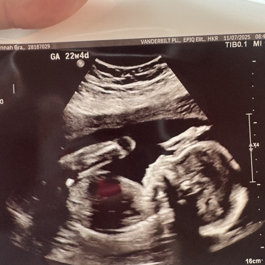 Photo shared by Hannah-Grace for their Babylist baby registry.