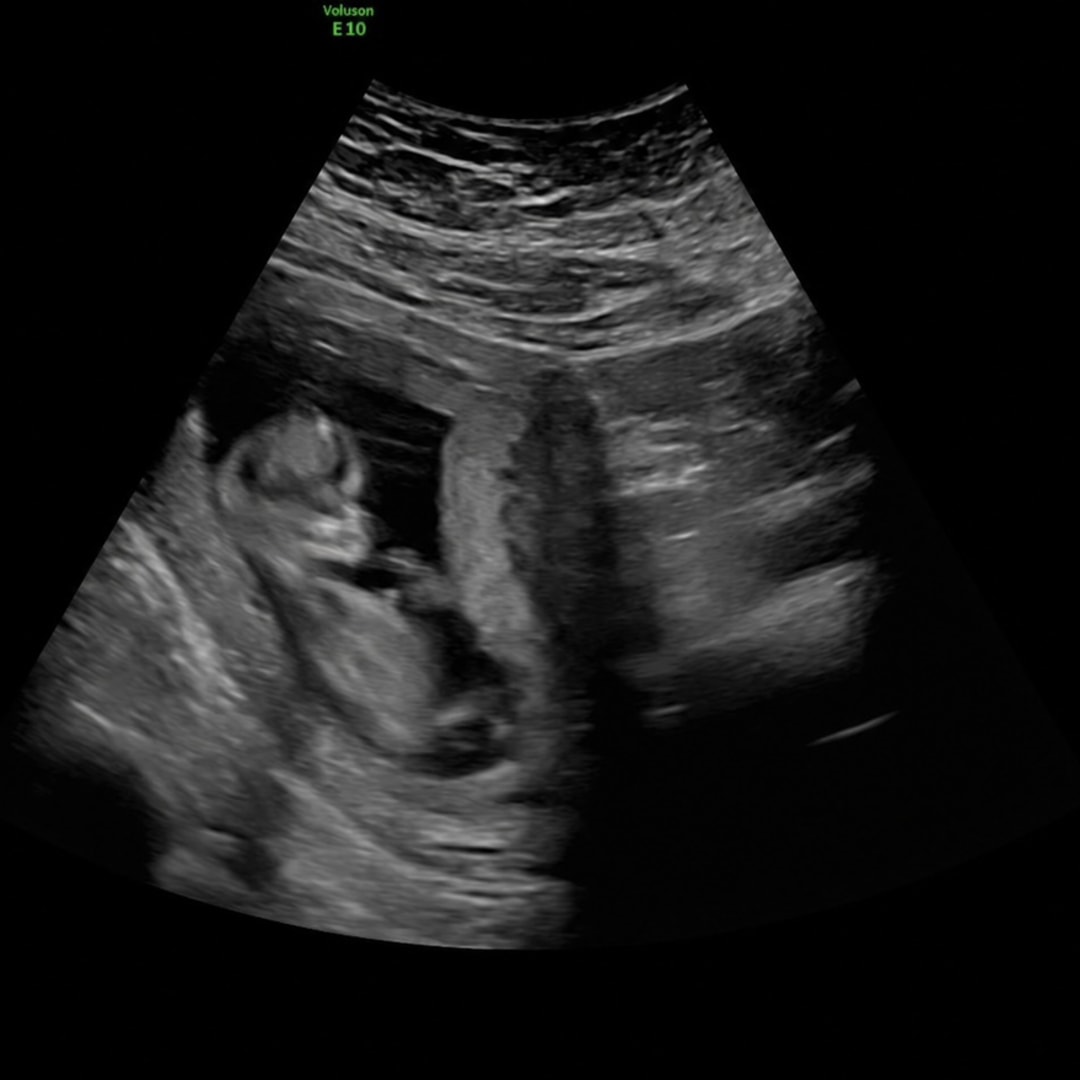 Photo shared by Courtney for their Babylist baby registry.