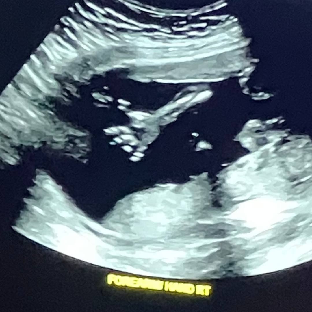 Photo shared by Haley for their Babylist baby registry.