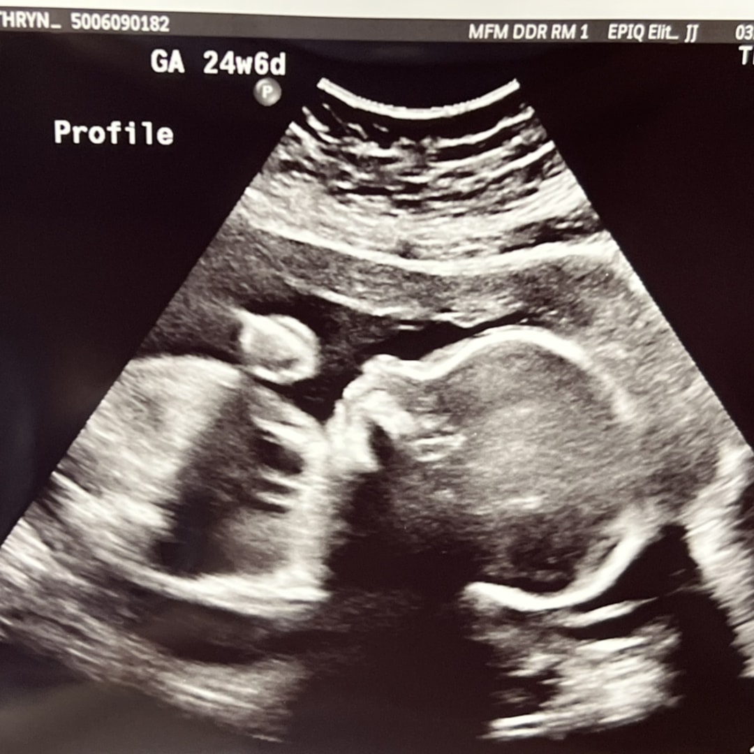 Photo shared by Kathryn for their Babylist baby registry.