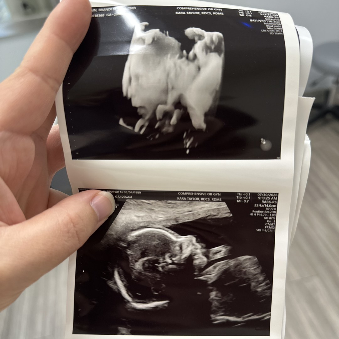 Photo shared by Brandi for their Babylist baby registry.