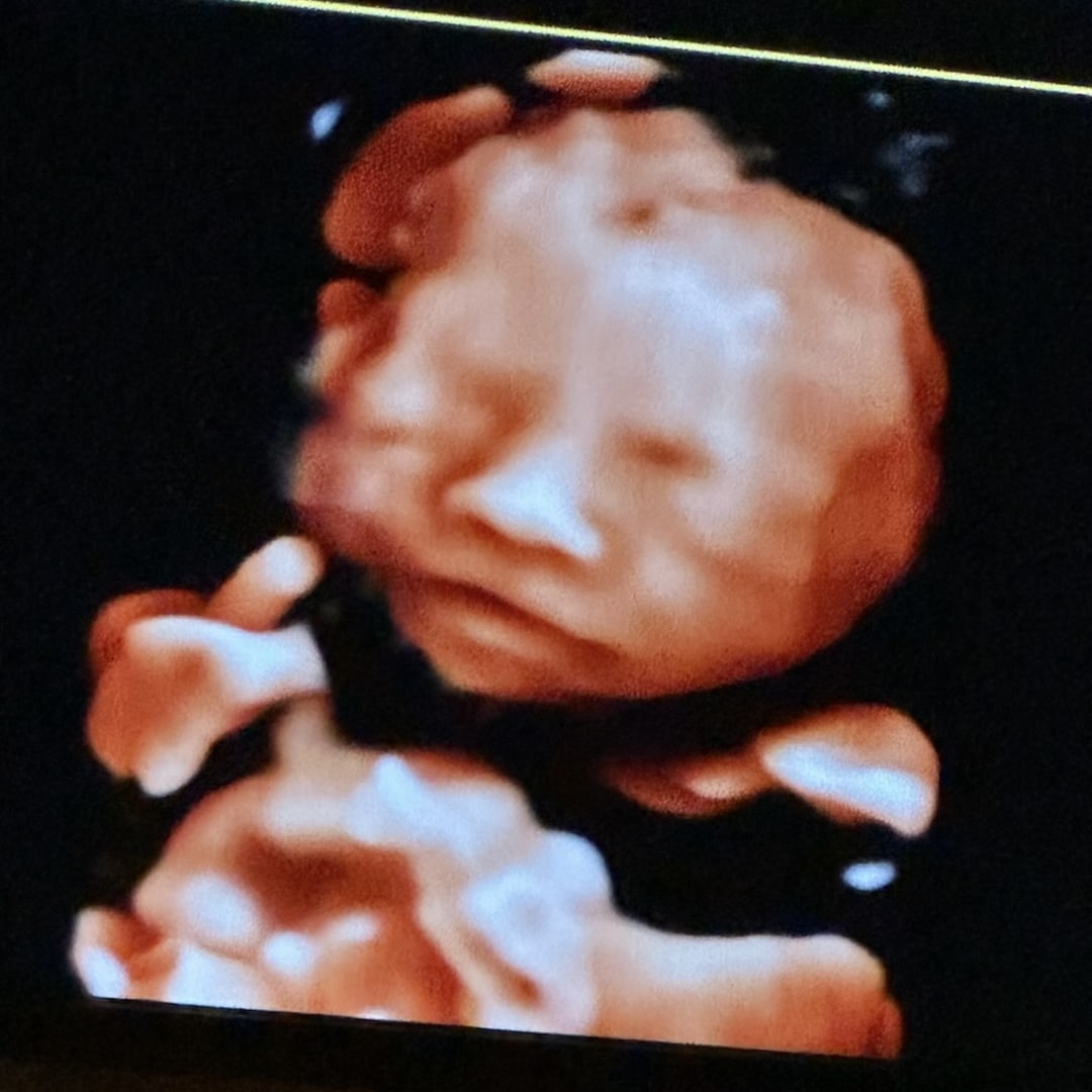 Photo shared by Jacqueline for their Babylist baby registry.
