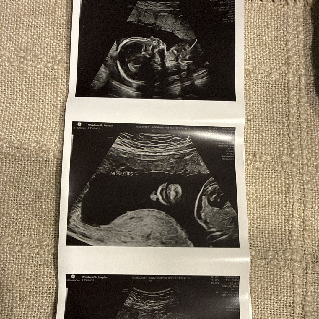 Photo shared by Hayden for their Babylist baby registry.