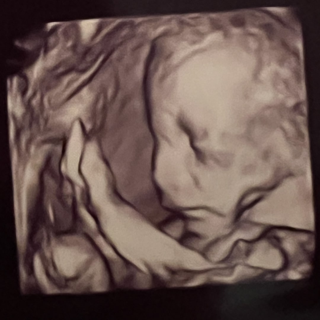 Photo shared by Lauren for their Babylist baby registry.