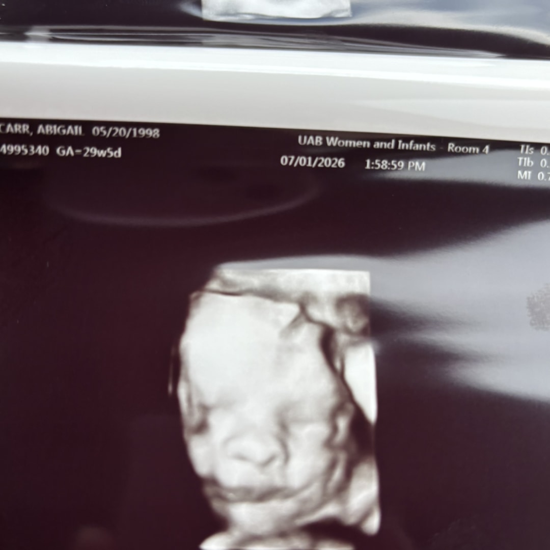Photo shared by Abby for their Babylist baby registry.