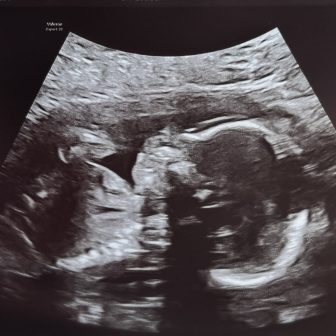 Photo shared by Autumn for their Babylist baby registry.