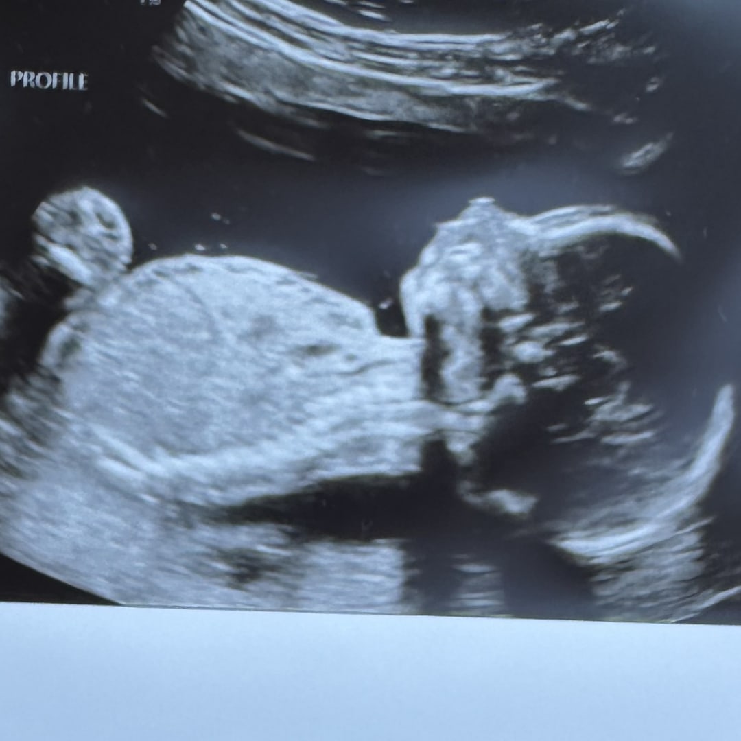 Photo shared by Amber for their Babylist baby registry.