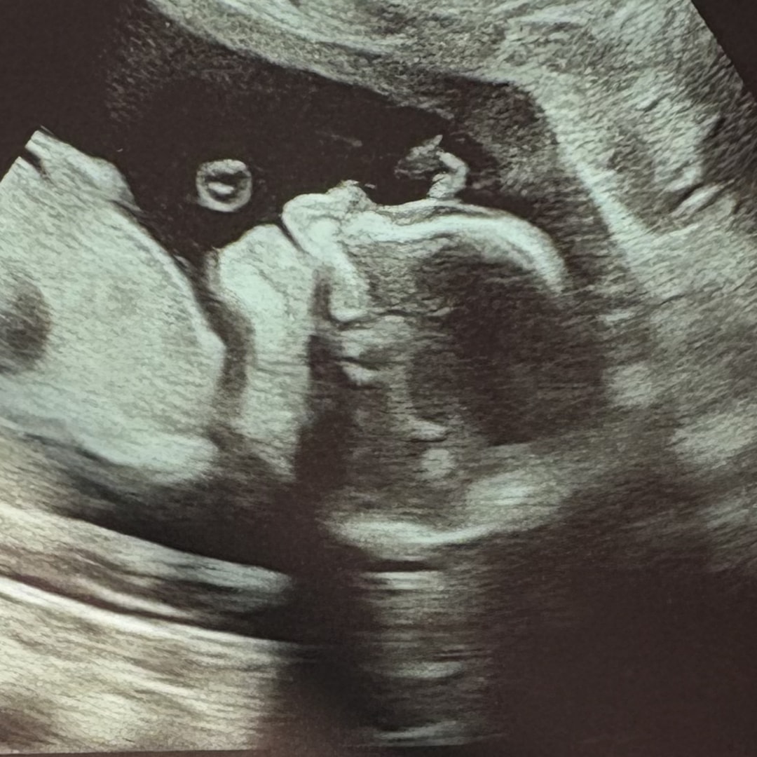 Photo shared by Samantha for their Babylist baby registry.