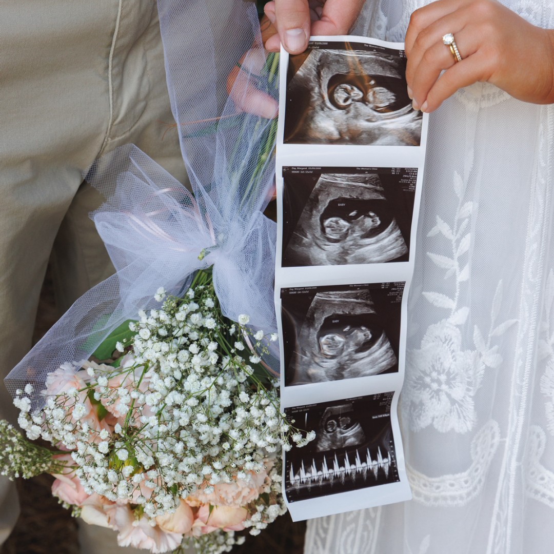Photo shared by Meg for their Babylist baby registry.