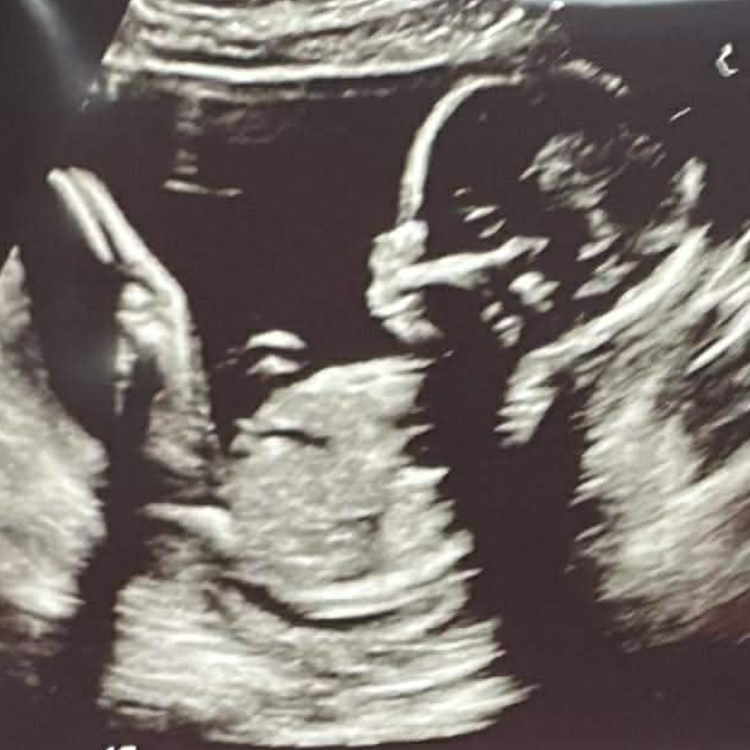 Photo shared by Brooke for their Babylist baby registry.