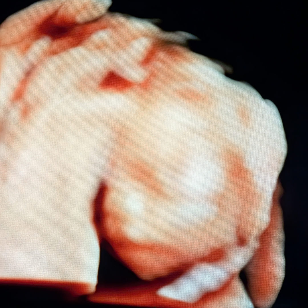 Photo shared by Hannah for their Babylist baby registry.