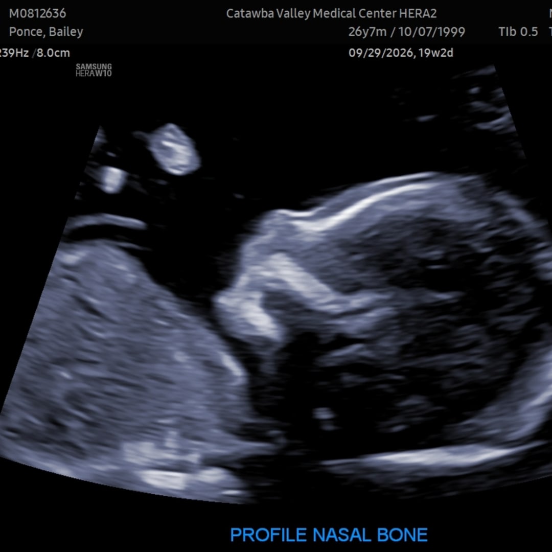 Photo shared by Bailey for their Babylist baby registry.