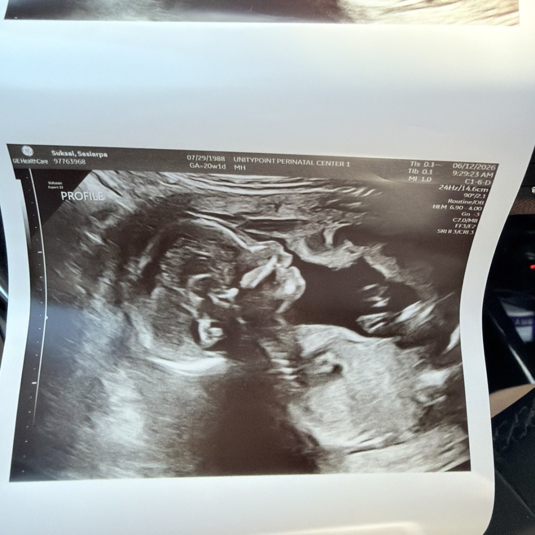 Photo shared by Sasiarpa for their Babylist baby registry.