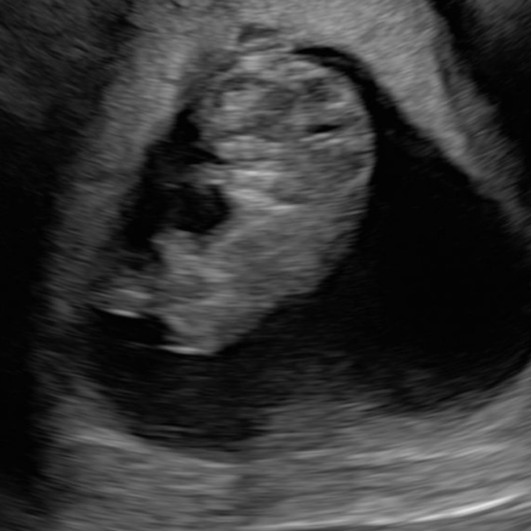 Photo shared by Aerial for their Babylist baby registry.