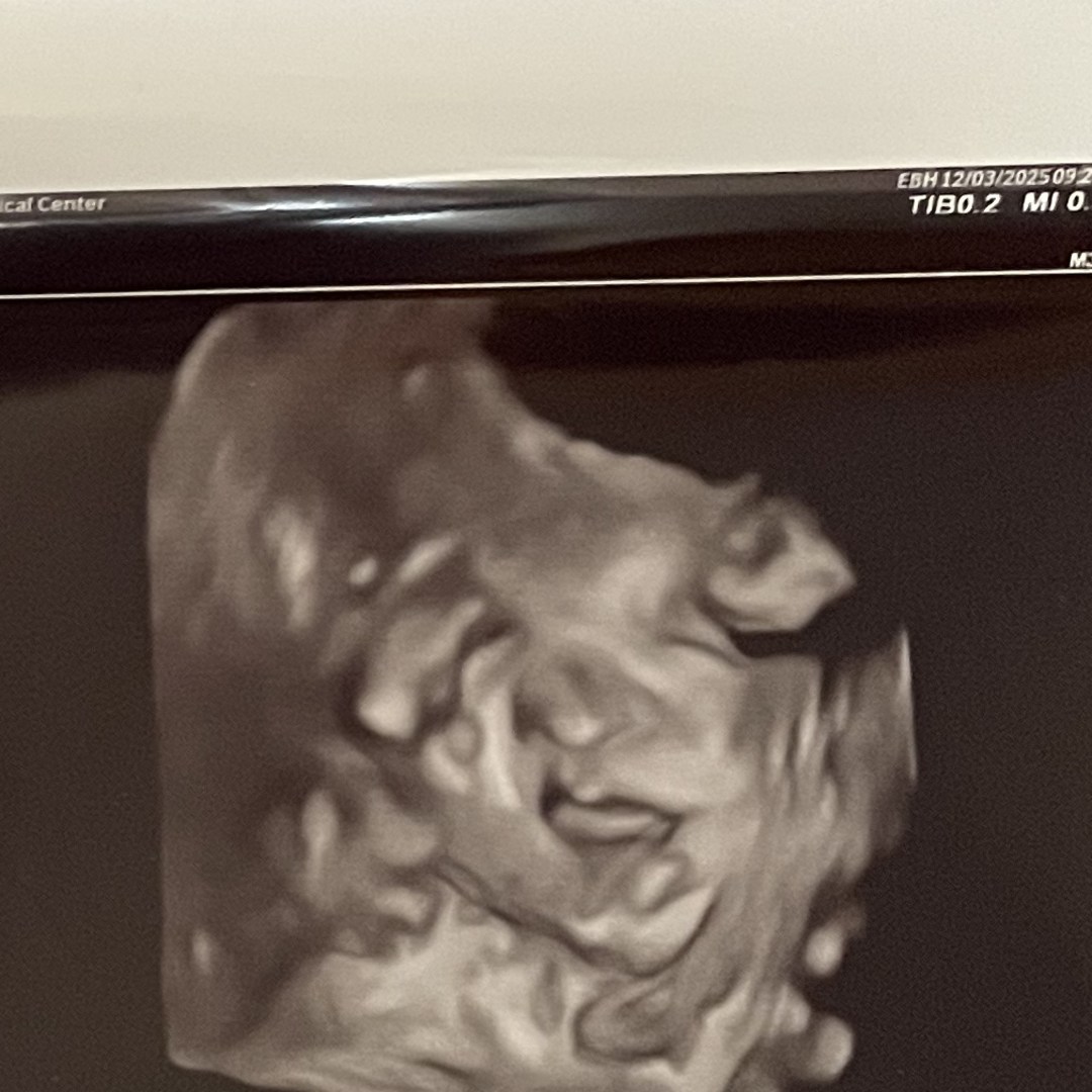 Photo shared by Alexandrea for their Babylist baby registry.